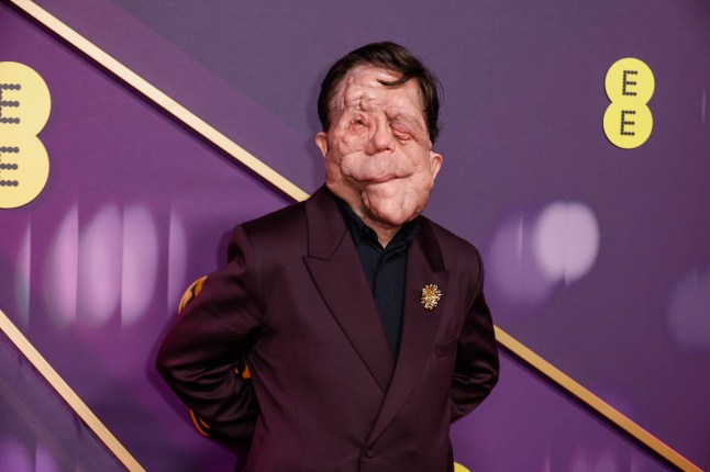 Adam Pearson poses for photographers upon arrival at the 78th British Academy Film Awards, BAFTA's, in London, Sunday, Feb. 16, 2025. (Photo by Joel C Ryan/Invision/AP)