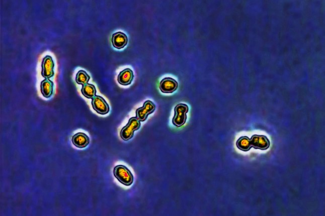 Streptococcus agalactiae bacteria, responsible for vaginal and urinary tract infections and newborn infections including meningitis and septicemia.