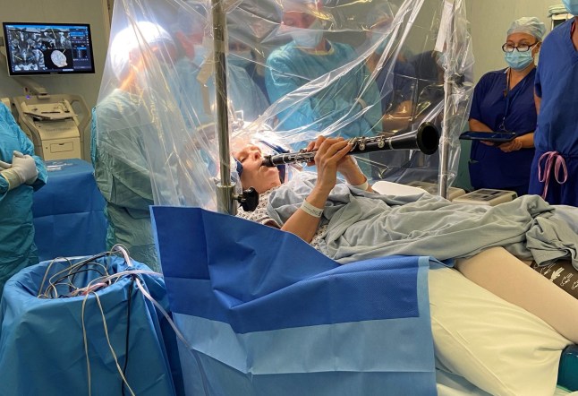EMBARGOED TO 0001 TUESDAY OCTOBER 21 Undated handout photo issued by King's College Hospital of Parkinson's patient Denise Bacon playing the clarinet while undergoing deep brain stimulation (DBS), enabling surgeons to see - and hear - immediate results. Denise, 65, from Crowborough in East Sussex, experienced instant improvement in her finger movements as the electrical current was delivered to her brain. During a four-hour operation Keyoumars Ashkan, a professor of neurosurgery, performed DBS to help relieve symptoms while Ms Bacon stayed awake. Issue date: Tuesday October 21, 2025. PA Photo. Photo credit should read: Karen Welsh/King's College Hospital/PA Wire NOTE TO EDITORS: This handout photo may only be used for editorial reporting purposes for the contemporaneous illustration of events, things or the people in the image or facts mentioned in the caption. Reuse of the picture may require further permission from the copyright holder.