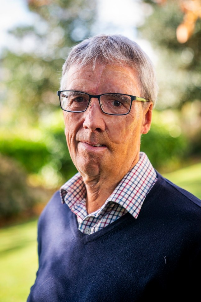 Dave Richards, at his home in Budliegh Salterton, Devon. As part of his treatment, Dave received a 3D prothesis that fits the space on his face and mimics his hair colour, eye colour and skin. // A cyclist injured by a drunk driver is the first to benefit from a unique NHS body parts printing centre - that built him a 3D face. Dave Richards, 75, was 'lucky to survive' the crash which damaged his back and pelvis and saw him break multiple ribs on one side of his body. He also received full thickness burns to the side of his face including his eye, nose and part of his neck. During his recovery, he was referred to Reconstructive Prosthetics, which has just opened The Bristol 3D Medical Centre. It is the first of its kind in the UK to have 3D scanning, design and printing of this kind in a single NHS location. The centre, based in Frenchay, Bristol, provides scientific and technical support to trauma patients through state-of-the-art digital technology and specialist reconstructive expertise. Dave, from Devon, was able to use the services at the centre after the accident. Photo released 27/10/2025