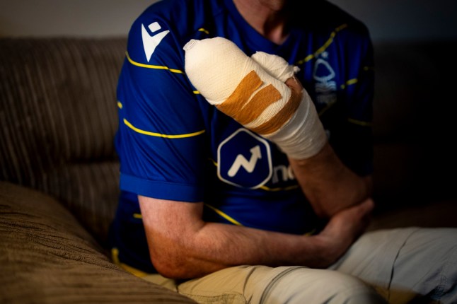 Stephen Crean with a cast after he was injured in the LNER train attack.