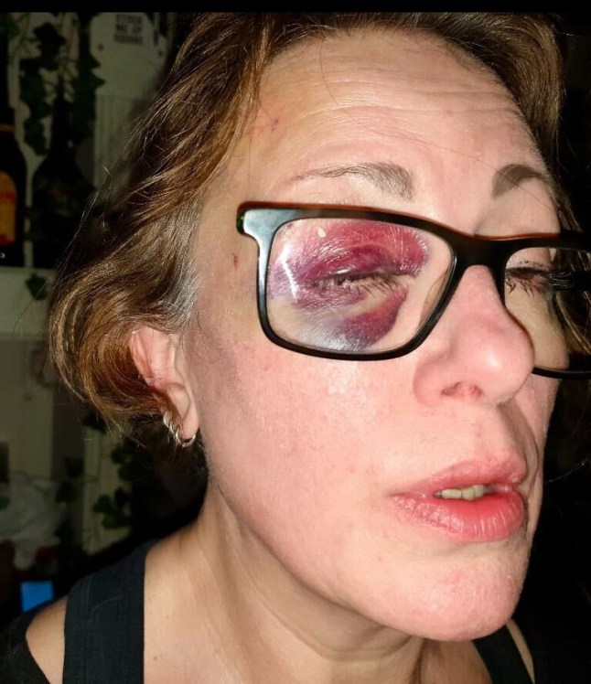 Pub landlady nearly beaten to death because she refused to serve man a pint