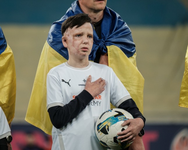LVIV, UKRAINE - NOVEMBER 2: Roman Oleksiv, 10 years old, who suffered severe burns after a Russian missile strike on Vinnytsia, performs Ukrainian anthem holding the ball prior to the Ukrainian Premier League match between FC Shakhtar Donetsk and FC Dynamo Kyiv at Arena Lviv on November 2, 2025 in Lviv, Ukraine. (Photo by Les Kasyanov/Global Images Ukraine via Getty Images)