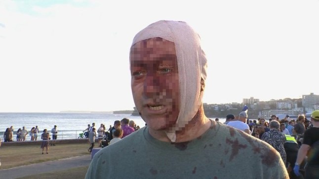 A man who was celebrating Hanukkah at Bondi Beach when two men opened fire in a terror attack that killed 12 people has described the terrifying moment it began. 'I was here with my family, it was a Hanukkah celebration, there were hundreds of people, there were children, there were elderly, families enjoying themselves,' Arsen Ostrovsky, an international human rights lawyer, told 9News. 'Children, kids at a festival, playing and then all of a sudden it's absolute chaos. There's gunfire, everywhere, people ducking, it was absolute chaos. 'We didn't know what was happening, where the gunfire was coming from.'